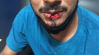 Homem toma socos na boca por chegar de madrugada de futebol com amigos na Mata do Jacinto