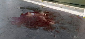 Rapaz é chamado de noiado e toma facada do cunhado