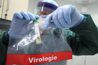 Equipe da OMS inicia investigação sobre origem do novo coronavírus