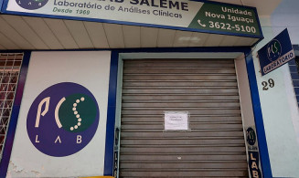 Mulher é presa por envolvimento em caso de HIV em transplante no Rio