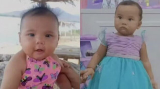 Testes confirmam que ameba rara causou morte de criança no Ceará