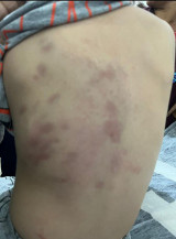 Homem é preso pela Guarda Municipal após agredir enteado de 3 anos em Dourados