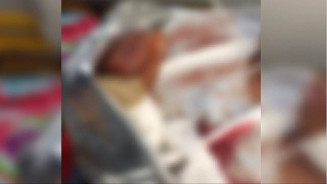 Idosa é socorrida em estado grave após ataque de pit bull no MS