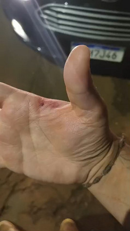 Corrida em carro de aplicativo acaba com motorista mordido pela passageira