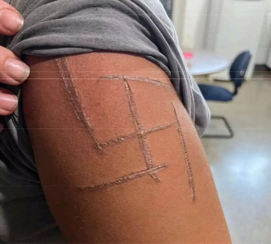 Justiça decreta prisão preventiva de trio acusado de marcar mulher trans com suástica