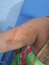 Jovem é esfaqueada por companheiro após crise de ciúmes em Dourados